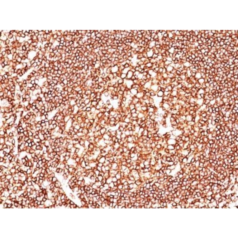 Immunohistochemistry (formalin-fixed, paraffin-embedded) - Anti-CD45 Antibody [2B11 + PD7/26] (CF®488A) (A352794) - Antibodies.com