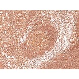 Immunohistochemistry (formalin-fixed, paraffin-embedded) - Anti-CD45 Antibody [2B11 + PD7/26] (CF®594) (A352795) - Antibodies.com