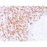 Immunohistochemistry (formalin-fixed, paraffin-embedded) - Anti-CD8 alpha Antibody [C8/144B] (CF®405S) (A352797) - Antibodies.com