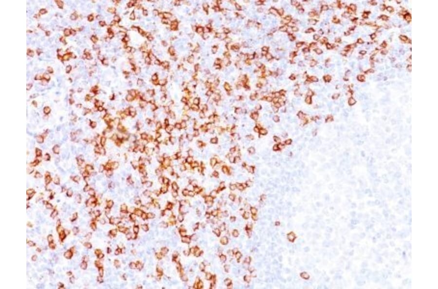Immunohistochemistry (formalin-fixed, paraffin-embedded) - Anti-CD8 alpha Antibody [C8/144B] (CF®740) (A352801) - Antibodies.com