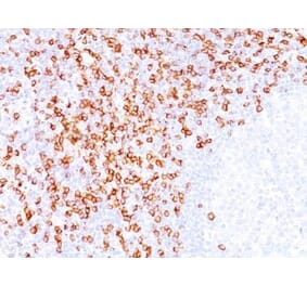 Immunohistochemistry (formalin-fixed, paraffin-embedded) - Anti-CD8 alpha Antibody [C8/144B] (Biotin) (A352805) - Antibodies.com