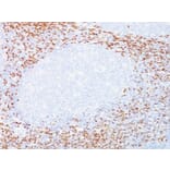 Immunohistochemistry (formalin-fixed, paraffin-embedded) - Anti-CD8 alpha Antibody [C8/468 + C8/144B] (CF®405S) (A352806) - Antibodies.com