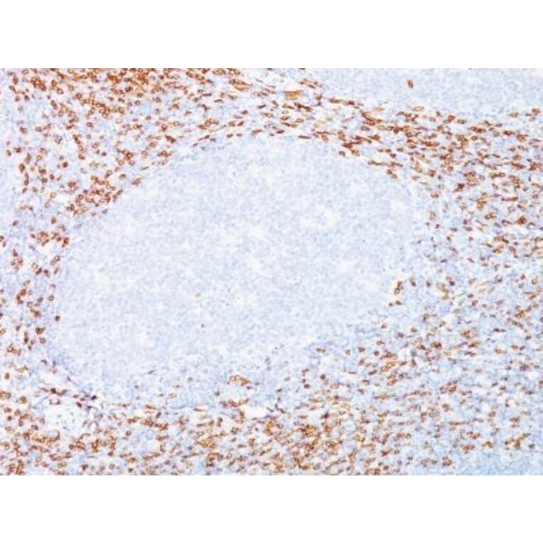 Immunohistochemistry (formalin-fixed, paraffin-embedded) - Anti-CD8 alpha Antibody [C8/468 + C8/144B] (CF®640R) (A352807) - Antibodies.com