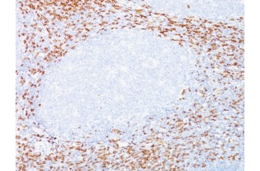 Immunohistochemistry (formalin-fixed, paraffin-embedded) - Anti-CD8 alpha Antibody [C8/468 + C8/144B] (CF®488A) (A352811) - Antibodies.com