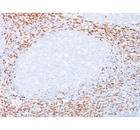 Immunohistochemistry (formalin-fixed, paraffin-embedded) - Anti-CD8 alpha Antibody [C8/468 + C8/144B] (Biotin) (A352813) - Antibodies.com