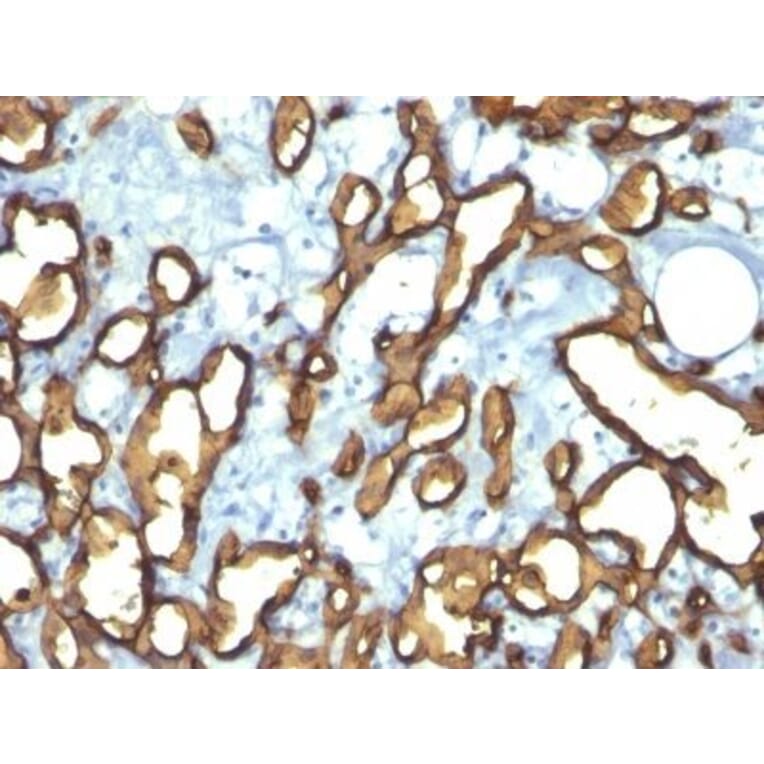 Immunohistochemistry (formalin-fixed, paraffin-embedded) - Anti-CD34 Antibody [HPCA1/763] (CF®405S) (A352814) - Antibodies.com