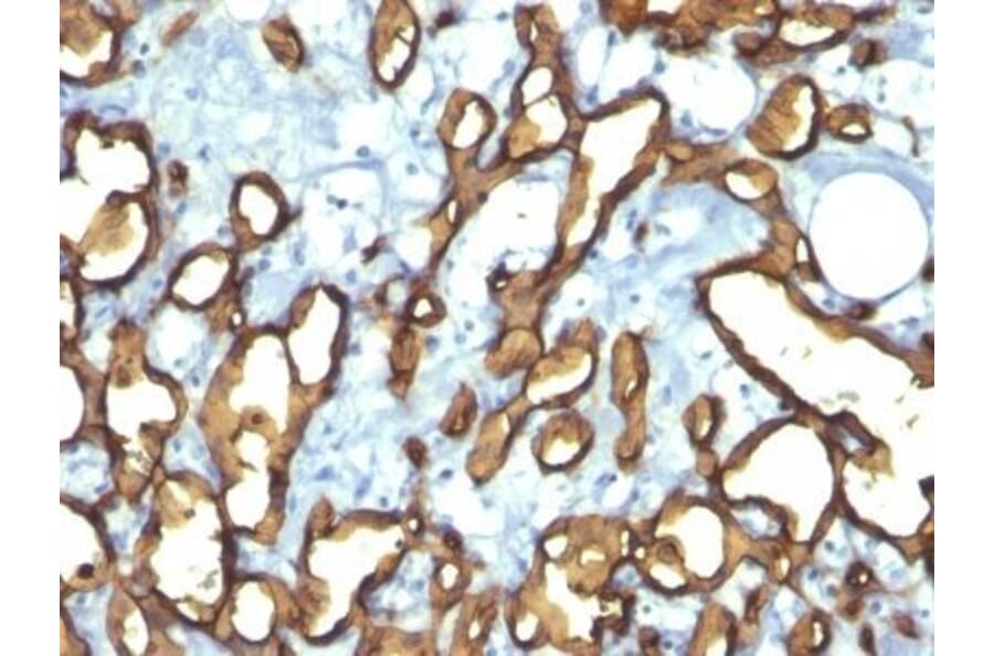 Immunohistochemistry (formalin-fixed, paraffin-embedded) - Anti-CD34 Antibody [HPCA1/763] (CF®640R) (A352815) - Antibodies.com