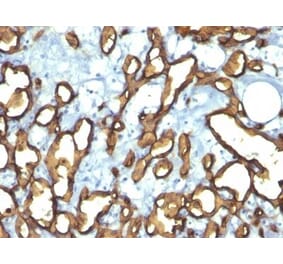 Immunohistochemistry (formalin-fixed, paraffin-embedded) - Anti-CD34 Antibody [HPCA1/763] (CF®740) (A352818) - Antibodies.com