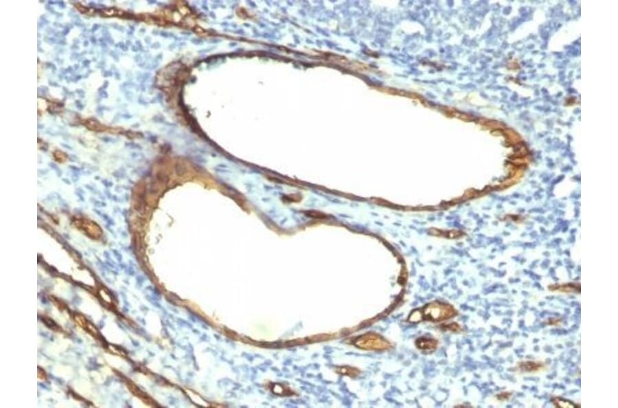 Immunohistochemistry (formalin-fixed, paraffin-embedded) - Anti-CD34 Antibody [HPCA1/763] (CF®740) (A352818) - Antibodies.com