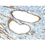 Immunohistochemistry (formalin-fixed, paraffin-embedded) - Anti-CD34 Antibody [HPCA1/763] (CF®594) (A352820) - Antibodies.com