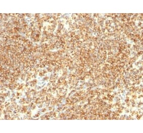 Immunohistochemistry (formalin-fixed, paraffin-embedded) - Anti-CD20 Antibody [IGEL/773] (CF®405S) (A352830) - Antibodies.com