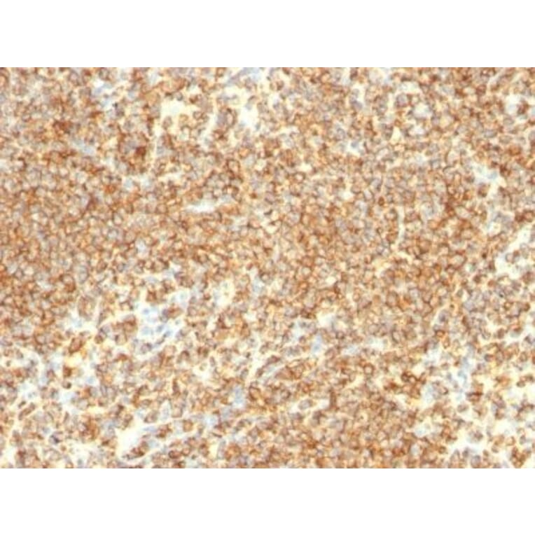 Immunohistochemistry (formalin-fixed, paraffin-embedded) - Anti-CD20 Antibody [IGEL/773] (CF®640R) (A352831) - Antibodies.com
