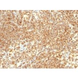 Immunohistochemistry (formalin-fixed, paraffin-embedded) - Anti-CD20 Antibody [IGEL/773] (CF®488A) (A352835) - Antibodies.com