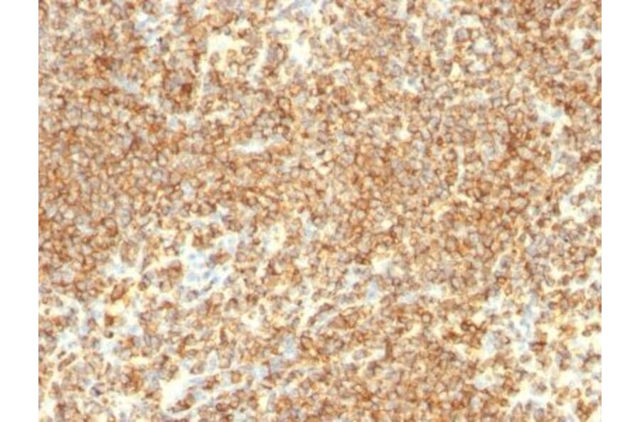 Immunohistochemistry (formalin-fixed, paraffin-embedded) - Anti-CD20 Antibody [IGEL/773] (CF®594) (A352836) - Antibodies.com