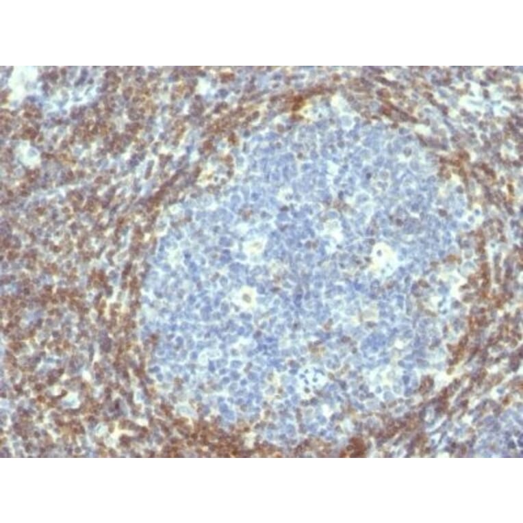 Immunohistochemistry (formalin-fixed, paraffin-embedded) - Anti-Bcl-2 Antibody [BCL2/782] (CF®640R) (A352847) - Antibodies.com