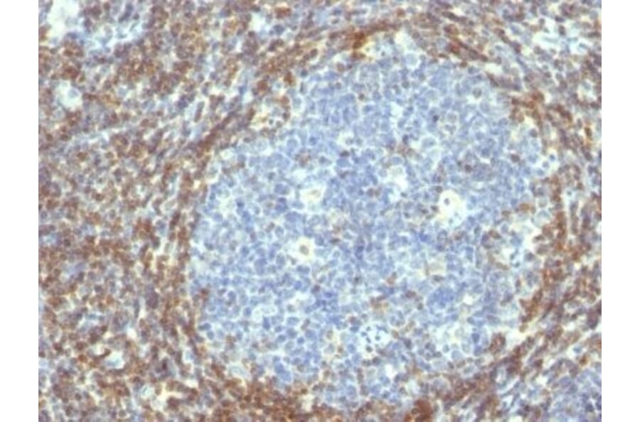 Immunohistochemistry (formalin-fixed, paraffin-embedded) - Anti-Bcl-2 Antibody [BCL2/782] (CF®740) (A352850) - Antibodies.com