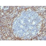 Immunohistochemistry (formalin-fixed, paraffin-embedded) - Anti-Bcl-2 Antibody [BCL2/782] (CF®740) (A352850) - Antibodies.com