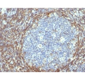 Immunohistochemistry (formalin-fixed, paraffin-embedded) - Anti-Bcl-2 Antibody [BCL2/782] (Biotin) (A352853) - Antibodies.com