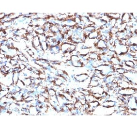 Immunohistochemistry (formalin-fixed, paraffin-embedded) - Anti-alpha Smooth Muscle Actin Antibody [ACTA2/791] (CF®405S) (A352854) - Antibodies.com