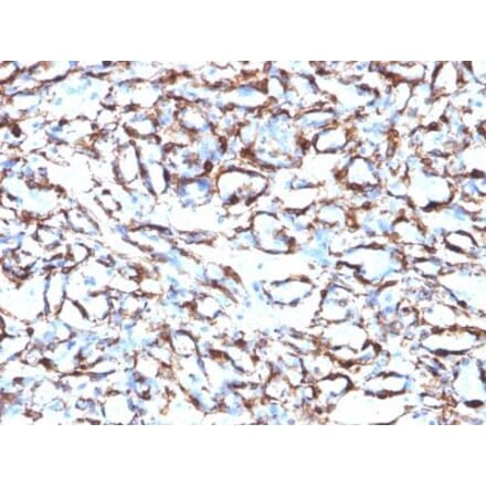 Immunohistochemistry (formalin-fixed, paraffin-embedded) - Anti-alpha Smooth Muscle Actin Antibody [ACTA2/791] (CF®405S) (A352854) - Antibodies.com
