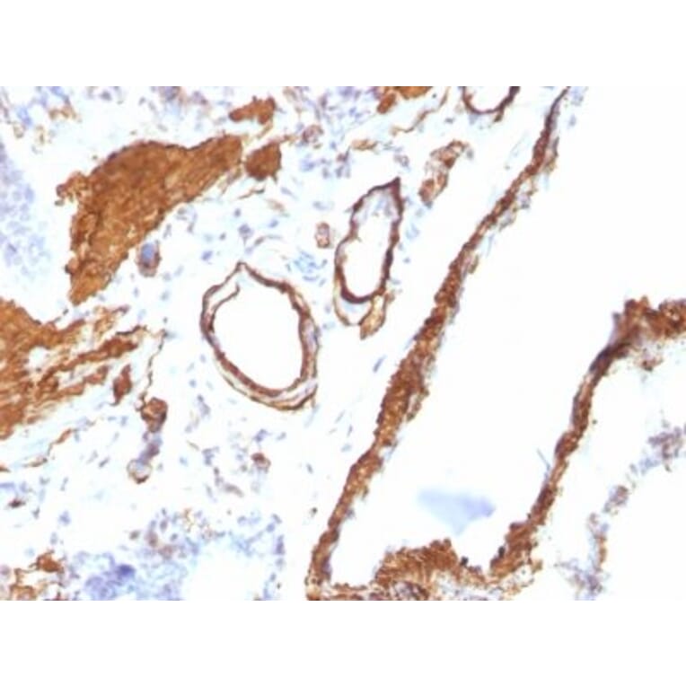 Immunohistochemistry (formalin-fixed, paraffin-embedded) - Anti-alpha Smooth Muscle Actin Antibody [ACTA2/791] (CF®405S) (A352854) - Antibodies.com