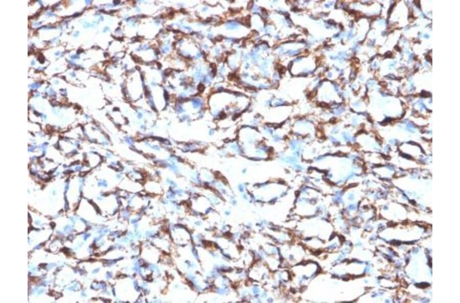 Immunohistochemistry (formalin-fixed, paraffin-embedded) - Anti-alpha Smooth Muscle Actin Antibody [ACTA2/791] (CF®640R) (A352855) - Antibodies.com