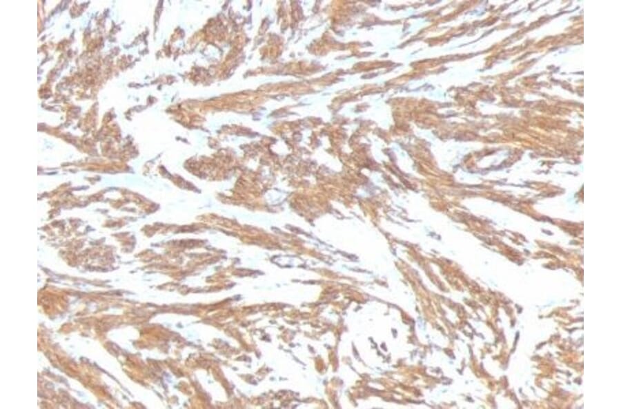 Immunohistochemistry (formalin-fixed, paraffin-embedded) - Anti-alpha Smooth Muscle Actin Antibody [ACTA2/791] (CF®640R) (A352855) - Antibodies.com