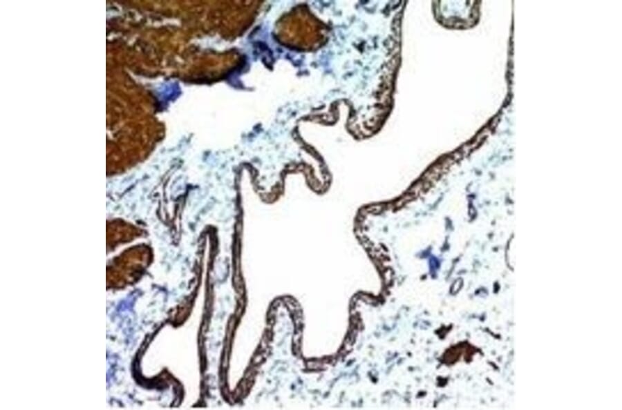 Immunohistochemistry (formalin-fixed, paraffin-embedded) - Anti-alpha Smooth Muscle Actin Antibody [ACTA2/791] (CF®640R) (A352855) - Antibodies.com