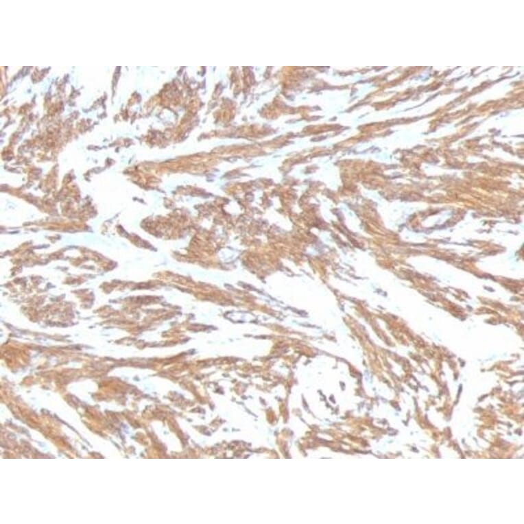 Immunohistochemistry (formalin-fixed, paraffin-embedded) - Anti-alpha Smooth Muscle Actin Antibody [ACTA2/791] (CF®647) (A352856) - Antibodies.com