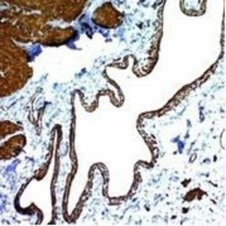 Immunohistochemistry (formalin-fixed, paraffin-embedded) - Anti-alpha Smooth Muscle Actin Antibody [ACTA2/791] (CF®647) (A352856) - Antibodies.com