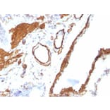 Immunohistochemistry (formalin-fixed, paraffin-embedded) - Anti-alpha Smooth Muscle Actin Antibody [ACTA2/791] (CF®568) (A352857) - Antibodies.com