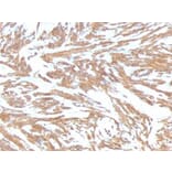 Immunohistochemistry (formalin-fixed, paraffin-embedded) - Anti-alpha Smooth Muscle Actin Antibody [ACTA2/791] (CF®740) (A352858) - Antibodies.com