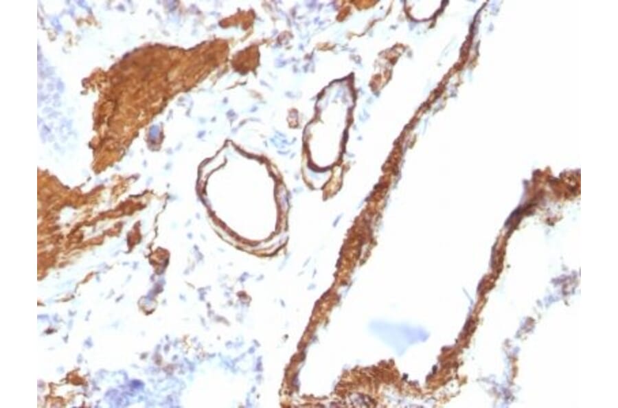 Immunohistochemistry (formalin-fixed, paraffin-embedded) - Anti-alpha Smooth Muscle Actin Antibody [ACTA2/791] (CF®488A) (A352859) - Antibodies.com