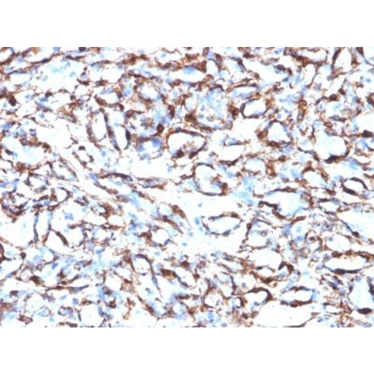 Immunohistochemistry (formalin-fixed, paraffin-embedded) - Anti-alpha Smooth Muscle Actin Antibody [ACTA2/791] (CF®594) (A352860) - Antibodies.com