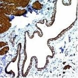 Immunohistochemistry (formalin-fixed, paraffin-embedded) - Anti-alpha Smooth Muscle Actin Antibody [ACTA2/791] (CF®594) (A352860) - Antibodies.com