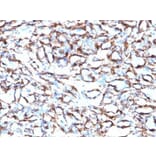 Immunohistochemistry (formalin-fixed, paraffin-embedded) - Anti-alpha Smooth Muscle Actin Antibody [ACTA2/791] (Biotin) (A352861) - Antibodies.com