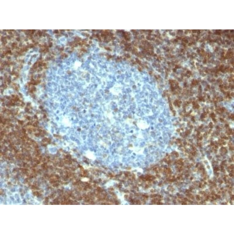 Immunohistochemistry (formalin-fixed, paraffin-embedded) - Anti-Bcl-2 Antibody [BCL2/796] (CF®640R) (A352863) - Antibodies.com