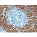 Immunohistochemistry (formalin-fixed, paraffin-embedded) - Anti-Bcl-2 Antibody [BCL2/796] (CF®640R) (A352863) - Antibodies.com