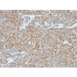 Immunohistochemistry (formalin-fixed, paraffin-embedded) - Anti-Bcl-2 Antibody [BCL2/796] (CF®568) (A352865) - Antibodies.com