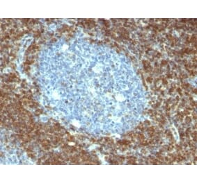 Immunohistochemistry (formalin-fixed, paraffin-embedded) - Anti-Bcl-2 Antibody [BCL2/796] (CF®488A) (A352867) - Antibodies.com