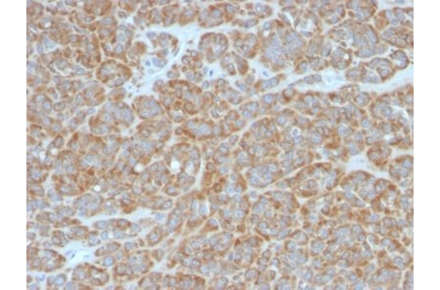 Immunohistochemistry (formalin-fixed, paraffin-embedded) - Anti-Bcl-2 Antibody [BCL2/796] (CF®594) (A352868) - Antibodies.com