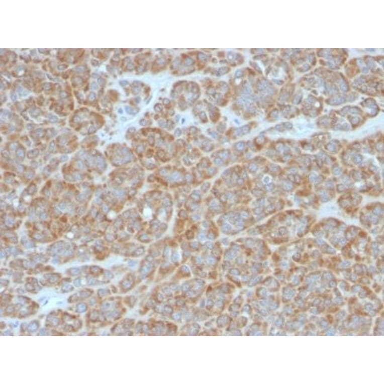 Immunohistochemistry (formalin-fixed, paraffin-embedded) - Anti-Bcl-2 Antibody [BCL2/796] (CF®594) (A352868) - Antibodies.com