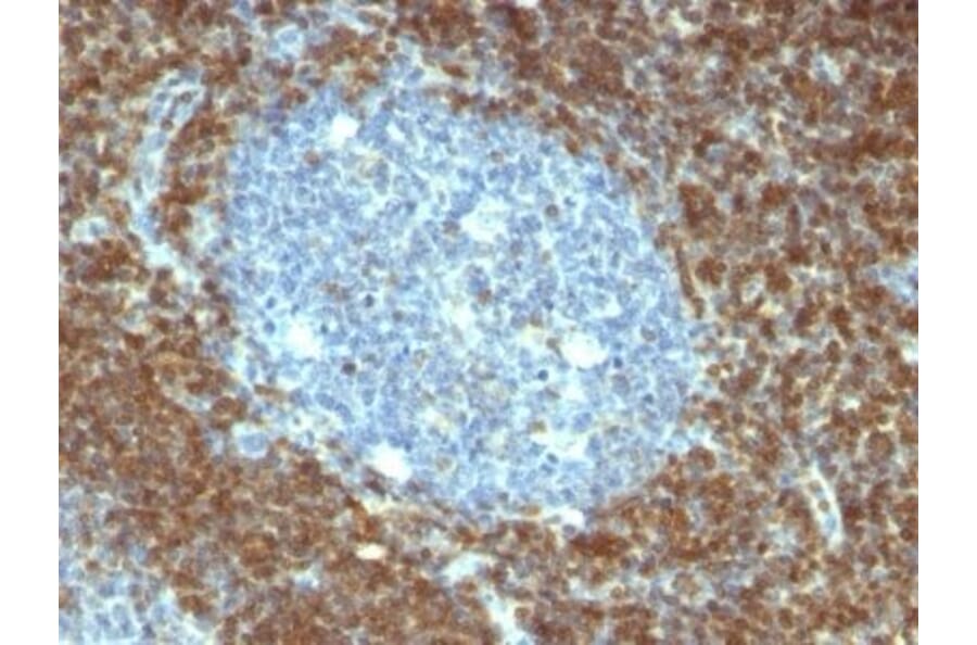 Immunohistochemistry (formalin-fixed, paraffin-embedded) - Anti-Bcl-2 Antibody [BCL2/796] (Biotin) (A352869) - Antibodies.com