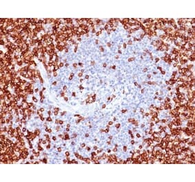 Immunohistochemistry (formalin-fixed, paraffin-embedded) - Anti-CD45RO Antibody [T200/797] (CF®640R) (A352871) - Antibodies.com