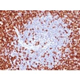Immunohistochemistry (formalin-fixed, paraffin-embedded) - Anti-CD45RO Antibody [T200/797] (CF®740) (A352874) - Antibodies.com