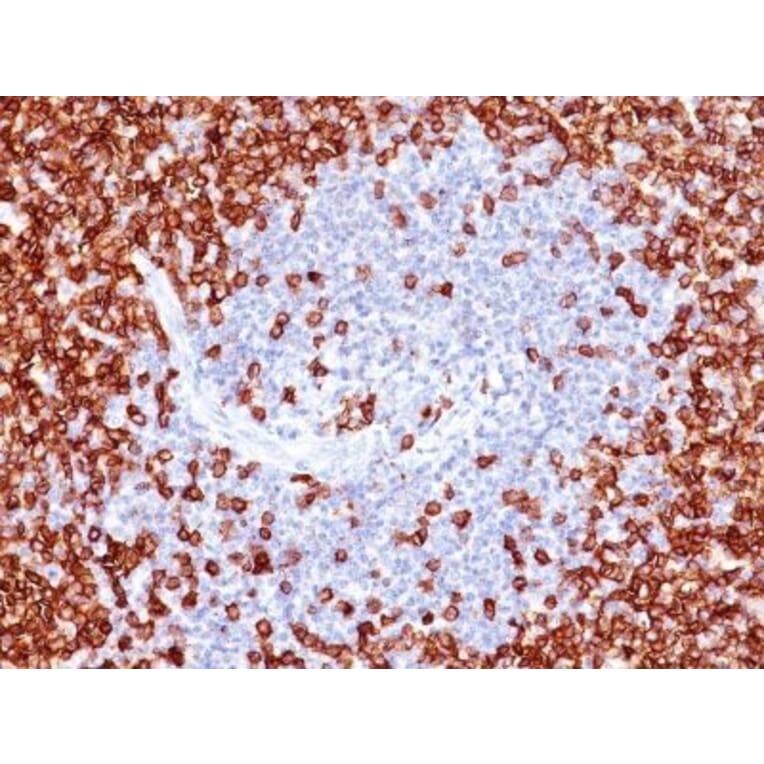 Immunohistochemistry (formalin-fixed, paraffin-embedded) - Anti-CD45RO Antibody [T200/797] (CF®488A) (A352875) - Antibodies.com