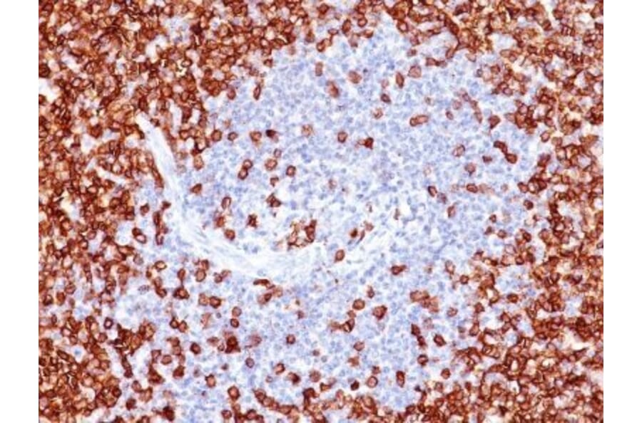 Immunohistochemistry (formalin-fixed, paraffin-embedded) - Anti-CD45RO Antibody [T200/797] (CF®594) (A352876) - Antibodies.com