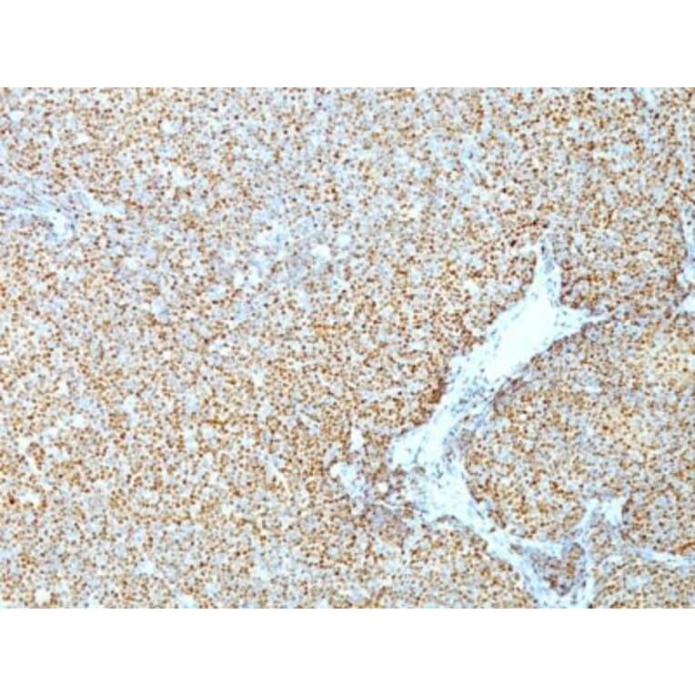 Immunohistochemistry (formalin-fixed, paraffin-embedded) - Anti-Cyclin D1 Antibody [CCND1/809] (CF®405S) (A352878) - Antibodies.com