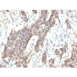 Immunohistochemistry (formalin-fixed, paraffin-embedded) - Anti-Cyclin D1 Antibody [CCND1/809] (CF®640R) (A352879) - Antibodies.com