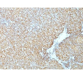 Immunohistochemistry (formalin-fixed, paraffin-embedded) - Anti-Cyclin D1 Antibody [CCND1/809] (CF®740) (A352883) - Antibodies.com